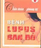 Bệnh Lupus ban đỏ - Chẩn đoán và phòng trị: Phần 1