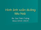 Bài giảng Hình ảnh xoắn đường tiêu hoá - BS. Cao Thiên Tượng