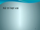 Bài giảng Xử trí kẹt vai