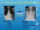 Bài giảng Các Yếu tố lâm sàng khi bị nhiễm cúm A H5N1