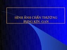 Bài giảng Hình ảnh chấn thương bụng kín: Gan