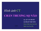 Bài giảng Hình ảnh CT chấn thương sọ não - BS. Lê Văn Phước, BS. Phạm Ngọc Hoa