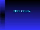 Bài giảng Bệnh Crohn