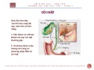 Bài giảng Sỏi mật - ThS. BS Nguyễn Phúc Học