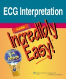 ECG interpretation made incredibly easy: Part 2