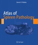 Atlas of spleen pathology: Part 2