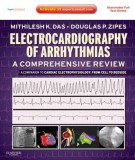 Electrocardiography of arrhythmias - A comprehensive review: Part 1