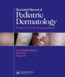 Illustrated manual of pediatric dermatology - Diagnosis and management (2nd edition): Part 1