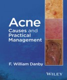 Acne causes and practical management: Part 1