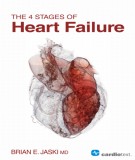  the 4 stages of heart failure: part 1