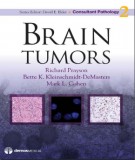  brain tumors: part 1
