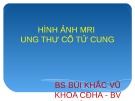 Bài giảng Hình ảnh MRI ung thư cổ tử cung - BS. Bùi Khắc Vũ