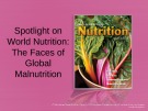 Lecture Discovering nutrition - Chapter 12a: Spotlight on world nutrition: The faces of global malnutrition