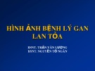 Bài giảng Hình ảnh bệnh lý gan lan tỏa - Trần Văn Lượng, Nguyễn Tố Ngân