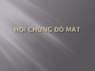 Bài giảng Hội chứng đỏ mắt (15 Tr.)