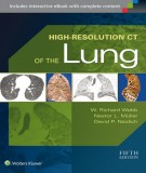 high-resolution ct of the lung (5/e): part 2