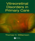  vitreoretinal disorders in primary care: part 1