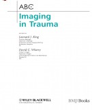  abc of imaging in trauma: part 2