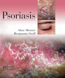  psoriasis: part 1