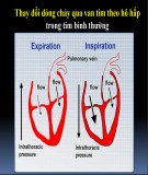 Bài giảng Cấp cứu tràn dịch màng tim gây ép tim - ThS.BS Hoàng Việt Anh