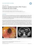 Ischemic duodenal ulceration after thoracic endovascular aortic repair