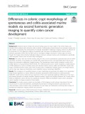 Differences in colonic crypt morphology of spontaneous and colitis-associated murine models via second harmonic generation imaging to quantify colon cancer development