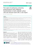 First report of pulmonary sclerosing pneomucytoma with malignant transformation in both cuboidal surface cells and stromal round cells: A case report