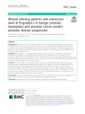 Altered staining patterns and expression level of Engrailed-2 in benign prostatic hyperplasia and prostate cancer predict prostatic disease progression