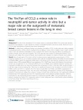 The Yin/Yan of CCL2: A minor role in neutrophil anti-tumor activity in vitro but a major role on the outgrowth of metastatic breast cancer lesions in the lung in vivo