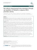 Ras induces experimental lung metastasis through up-regulation of RbAp46 to suppress RECK promoter activity