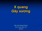 Bài giảng Xquang gãy xương – BS Lâm Đông Phong