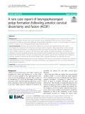 A rare case report of laryngopharyngeal polyp formation following anterior cervical discectomy and fusion (ACDF)