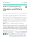 Pseudoaneurysm following hamstring tendon harvest in arthroscopic anterior cruciate ligament reconstruction: A case report