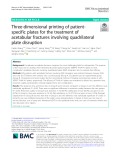 Three-dimensional printing of patientspecific plates for the treatment of acetabular fractures involving quadrilateral plate disruption