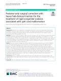 Posterior-only surgical correction with heavy halo-femoral traction for the treatment of rigid congenital scoliosis associated with split cord malformation
