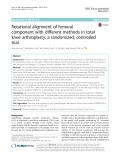 Rotational alignment of femoral component with different methods in total knee arthroplasty: A randomized, controlled trial