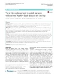 Total hip replacement in adult patients with severe Kashin-Beck disease of the hip