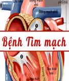 Tổng quan các bệnh về tim mạch