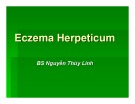 Bài giảng Eczema Herpeticum Herpeticum – BS. Nguyễn Thùy Linh