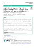 Augmented cerclage wire improves the fixation strength of a two-screw construct for humerus split type greater tuberosity fracture: A biomechanical study