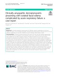 Clinically amyopathic dermatomyositis presenting with isolated facial edema complicated by acute respiratory failure: A case report