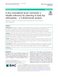 Is the contralateral lesser trochanter a reliable reference for planning of total hip arthroplasty – a 3-dimensional analysis