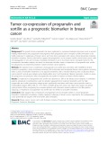 Tumor co-expression of progranulin and sortilin as a prognostic biomarker in breast cancer