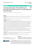 Coronal subluxation of the tibiofemoral joint before and after anterior cruciate ligament reconstruction