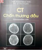 Chỉnh định CT trong chấn thương sọ não: Phần 2