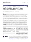 Rare presentation of Waldenström’s macroglobulinaemia requiring bilateral above-knee amputations: A case report