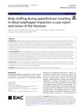 Body stuffing during apprehension resulting in distal esophageal impaction: A case report and review of the literature
