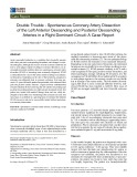 Double trouble-spontaneous coronary artery dissection of the left anterior descending and posterior descending arteries in a right dominant circuit: A case report