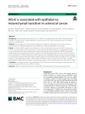 ARL4C is associated with epithelial-to-mesenchymal transition in colorectal cancer