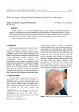 Tinea incognito-like generalized pustular psoriasis: A case report